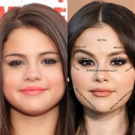 selena gomez boobs before and after|Selena Gomez before and after plastic surgery: boobs。